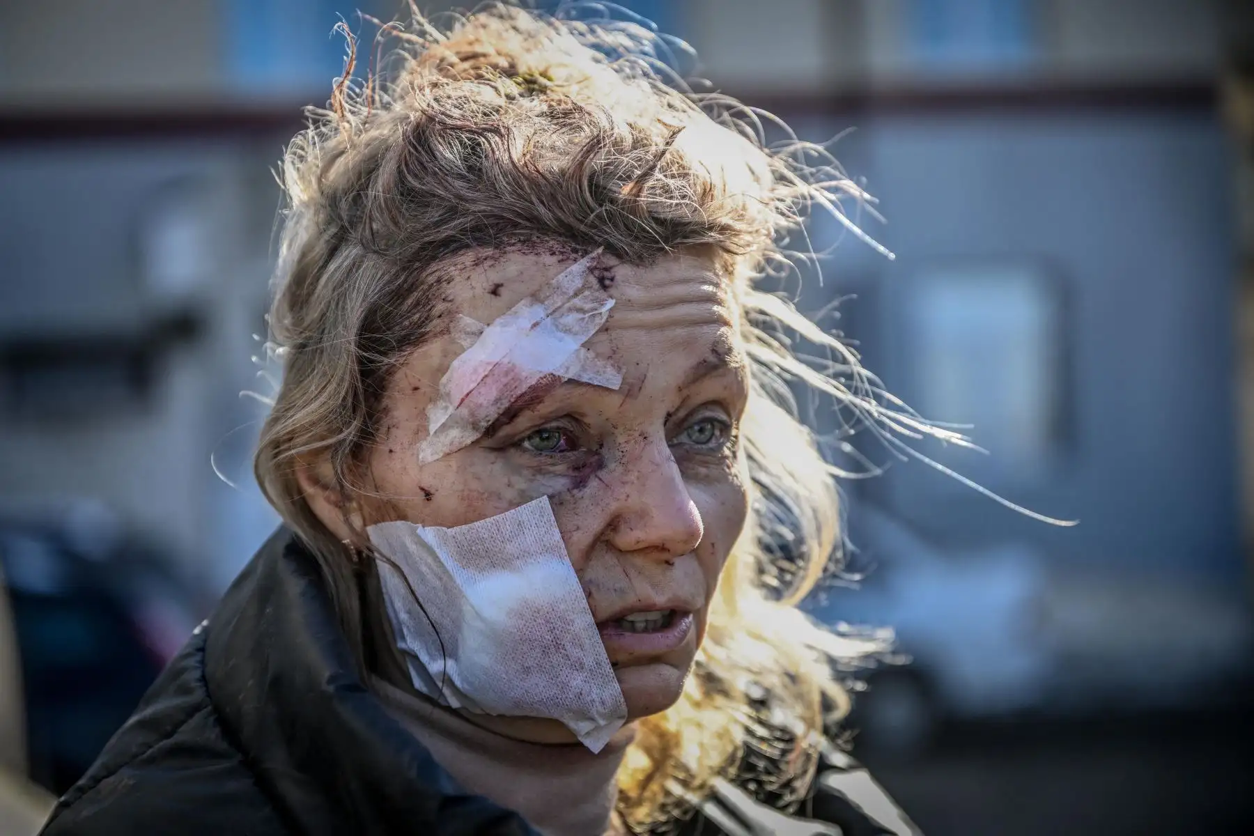 Una mujer herida frente a un hospital después del bombardeo de la ciudad de Chuguiv, en el este de Ucrania. Foto: AFP