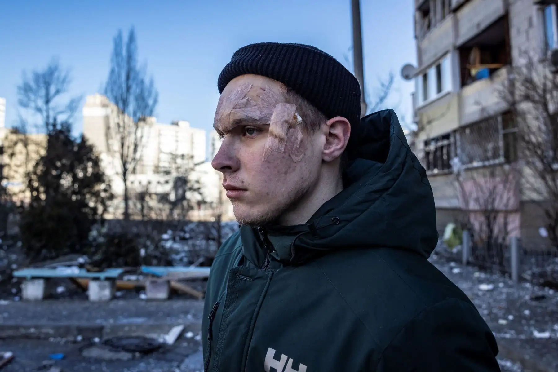 Un residente herido se encuentra junto a un edificio residencial que fue alcanzado por los escombros de un cohete derribado en Kiev. Foto: AFP