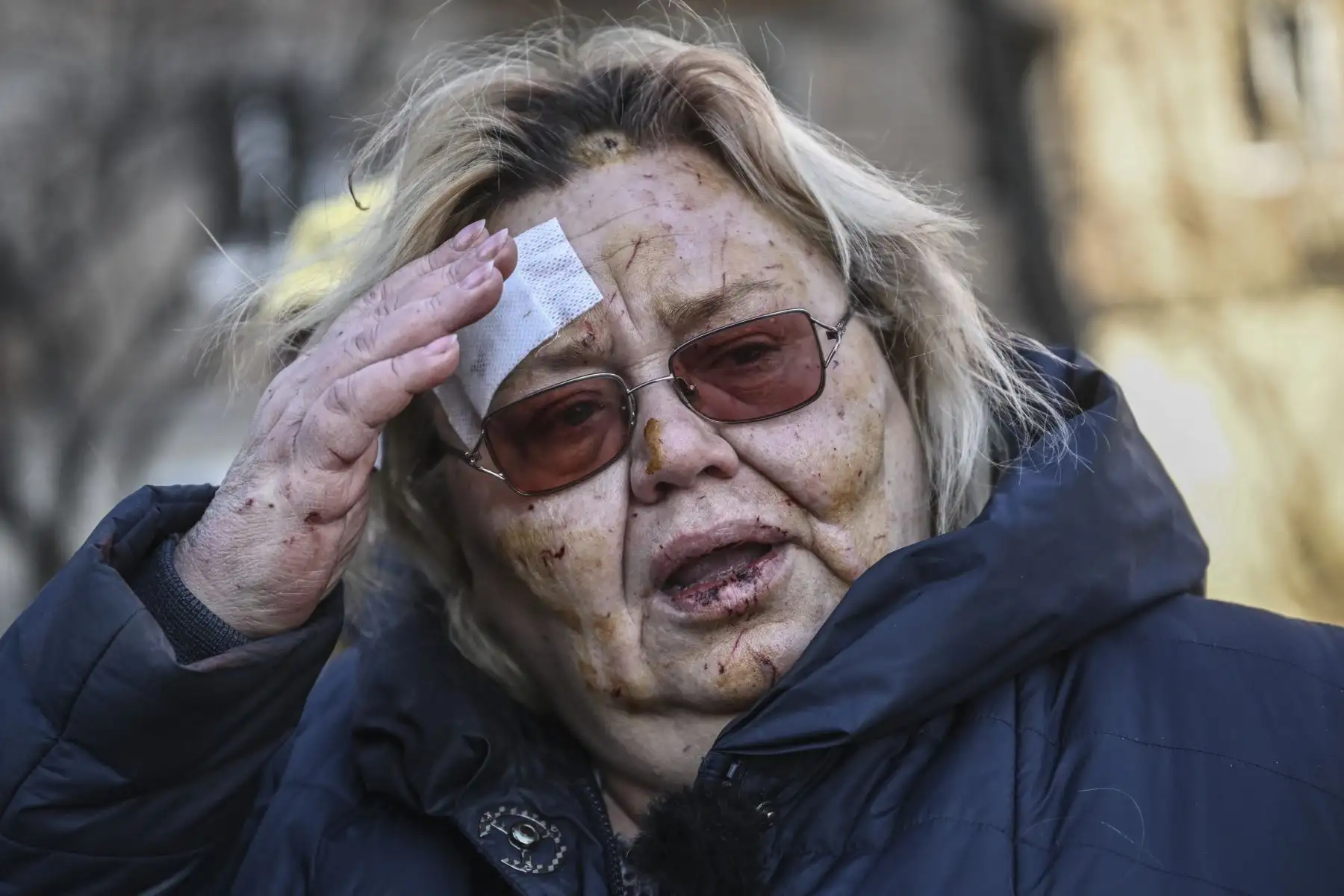Una mujer herida reacciona después de un bombardeo en una zona residencial de Kiev. Foto: AFP