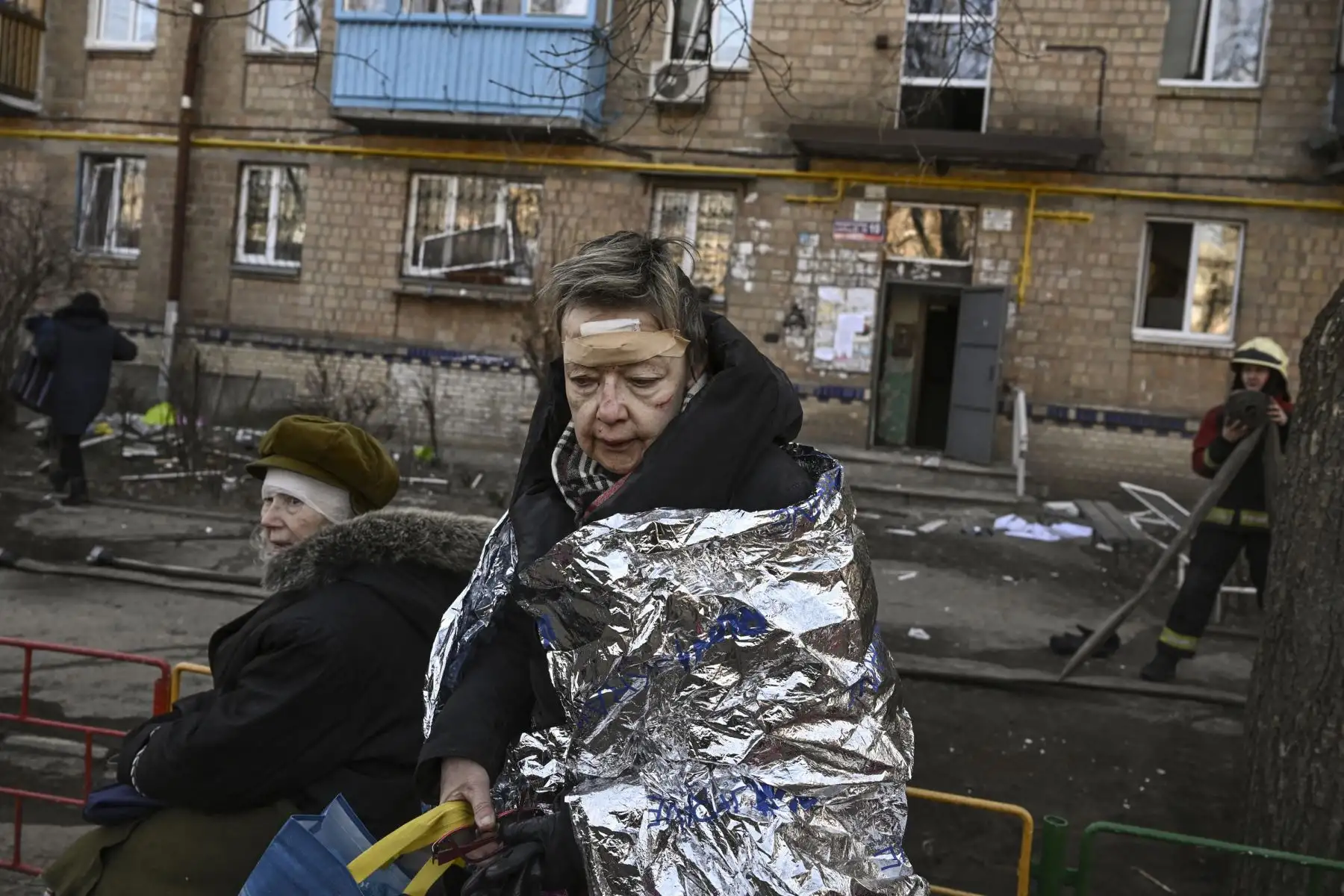 Una mujer herida observa mientras recibe tratamiento médico después de un bombardeo en una zona residencial de Kiev. Foto: AFP