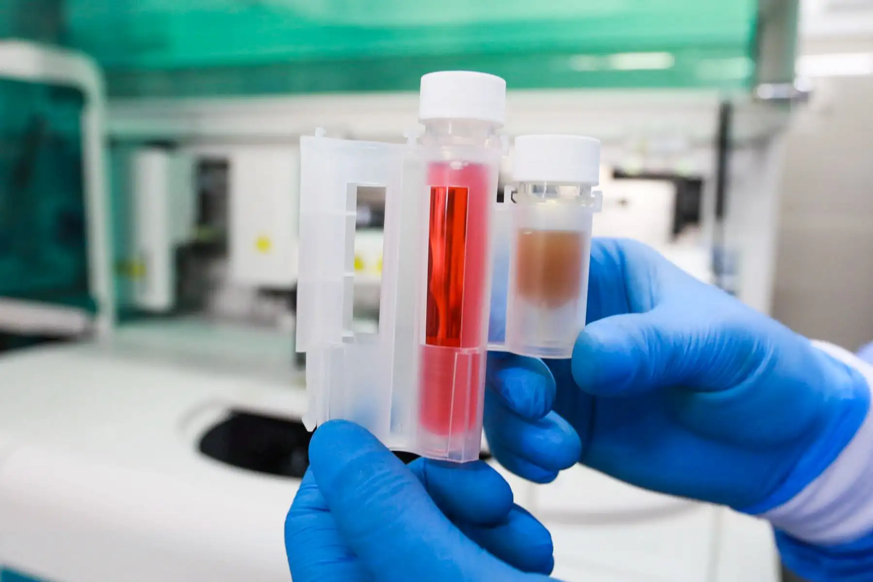 Minsa implementa tamizaje de cáncer de próstata que te da resultados en 20 minutos. Foto: ANDINA/Héctor Vinces