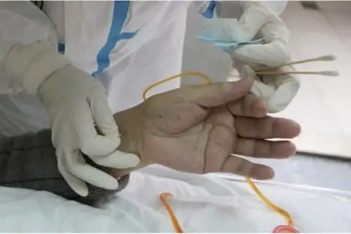 Con más de 2,000 años de historia, la medicina tradicional china es todavía muy utilizada por los pacientes chinos. Foto: ANDINA/Difusión