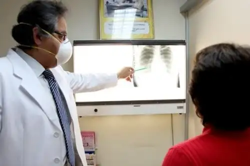 SIS financió más de 127,000 atenciones por TB durante la pandemia. Foto: ANDINA/Difusión.