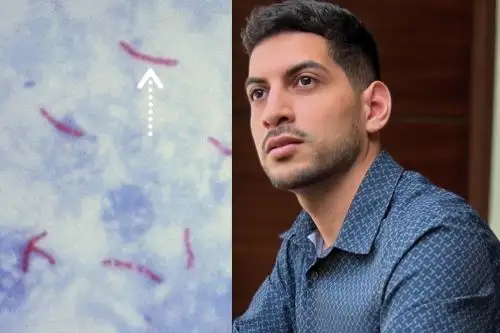 El investigador peruano Christian Elugo puede desarrollar este proyecto sobre la tuberculosis gracias a la beca Concytec que obtuvo, motivo por el cual reconoce su importancia.