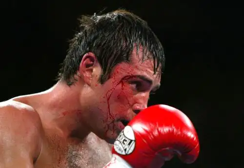 De la Hoya se retiró del boxeo en 2008, dejó un récord de 39 victorias y seis derrotas y ganó 11 títulos mundiales en seis diferentes pesos. Foto: AFP