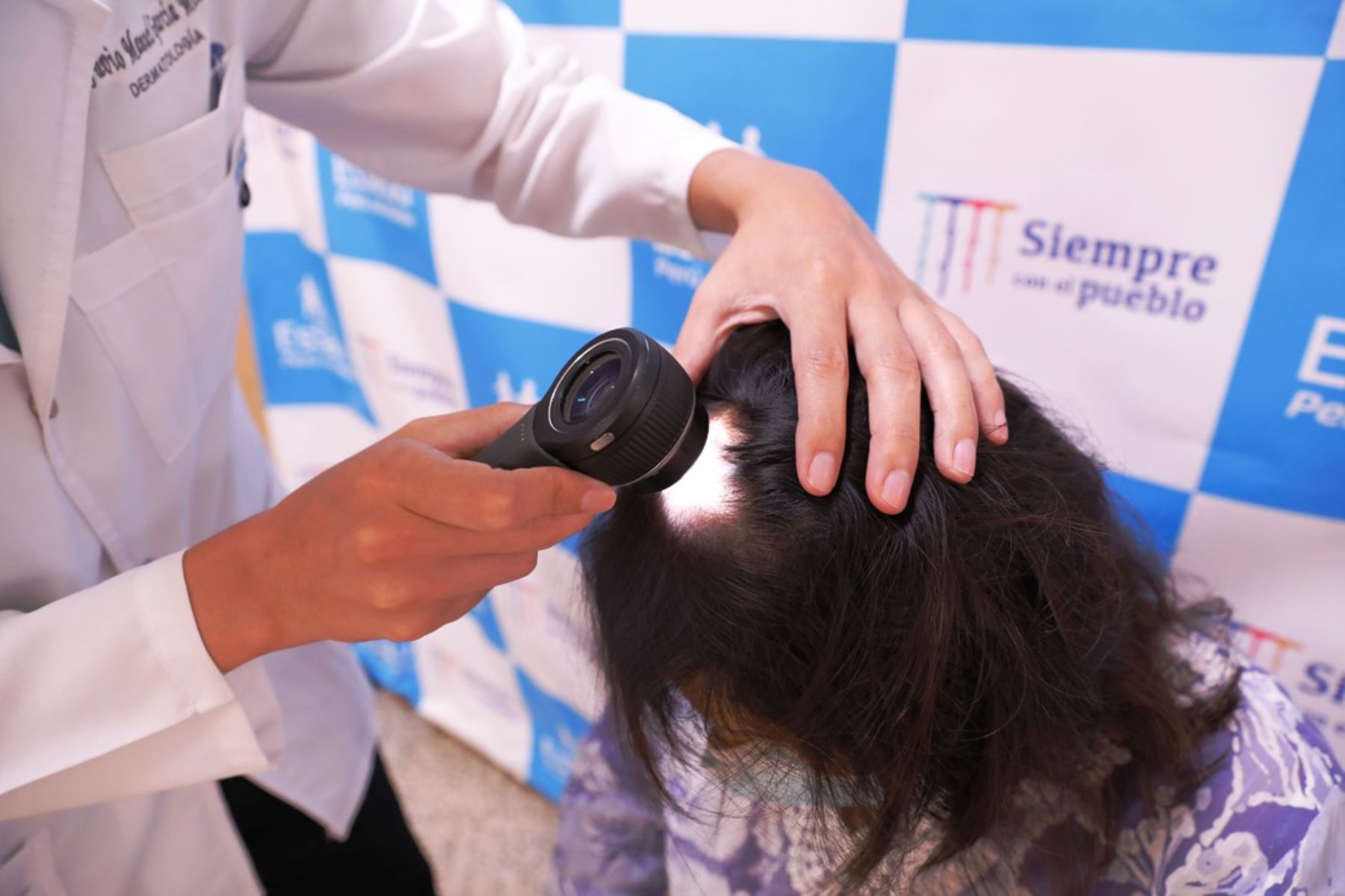 EsSalud: 60% de mujeres reportan caída del cabello tras sufrir covid-19. Foto: ANDINA/Difusión.