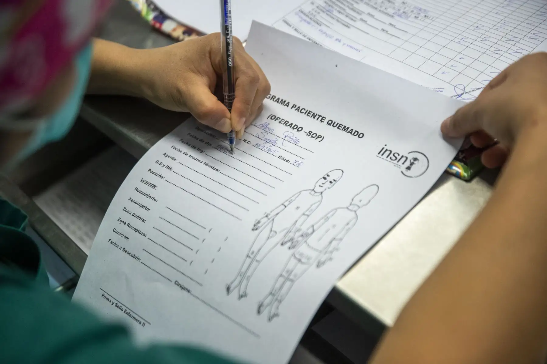 La microcirugía ayuda a los niños quemados mejorar su motricidad y calidad de vida, permitiéndoles jugar, ir al colegio y hacer su vida prácticamente normal. Desde el 2014, se han intervenido a 70 niños. La pandemia del covid-19 obligó a una pausa pero se ha retomado hace dos meses, tiempo durante el cual se hicieron cinco microcirugías, todas exitosas. Foto: ANDINA/Carla Patiño
