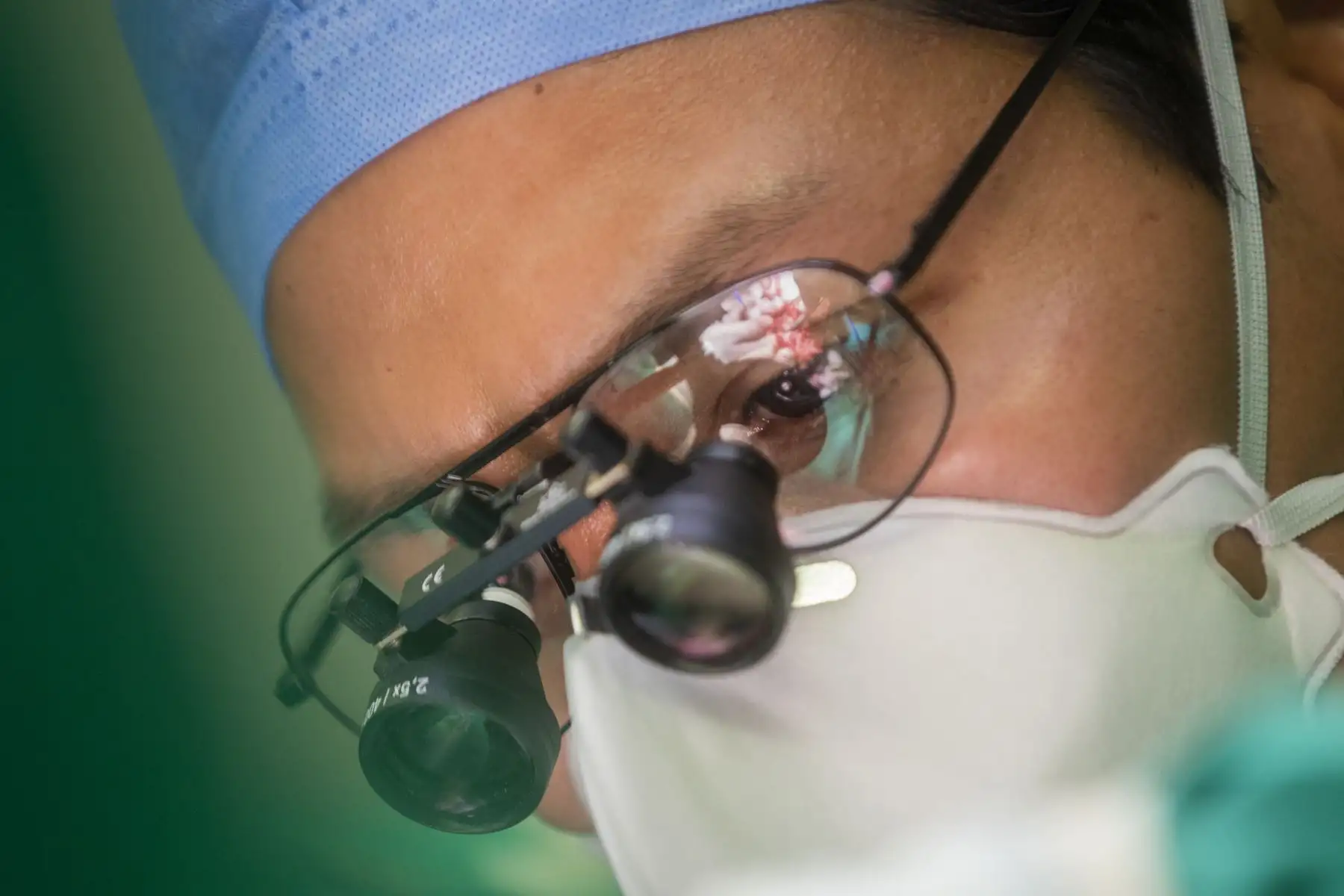 Microcirugías reconstructivas que mejoran la vida de niños quemados del INSN-San Borja. En estas intervenciones se usa un potente microscopio que aumenta 100 veces las imágenes, de manera que una arteria muy pequeña aparece muy grande y puede manipularse. Foto: ANDINA/Carla Patiño