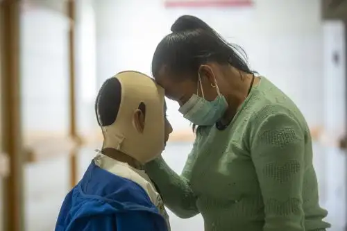 Denise, madre y padre de Erick, está agradecida con los cirujanos del INSN-San Borja por haber logrado reconstruirle el cuello a su hijo y mejorar su calidad de vida tras la quemadura que sufrió antes de los dos años. Foto: ANDINA/Carla Patiño Ramírez