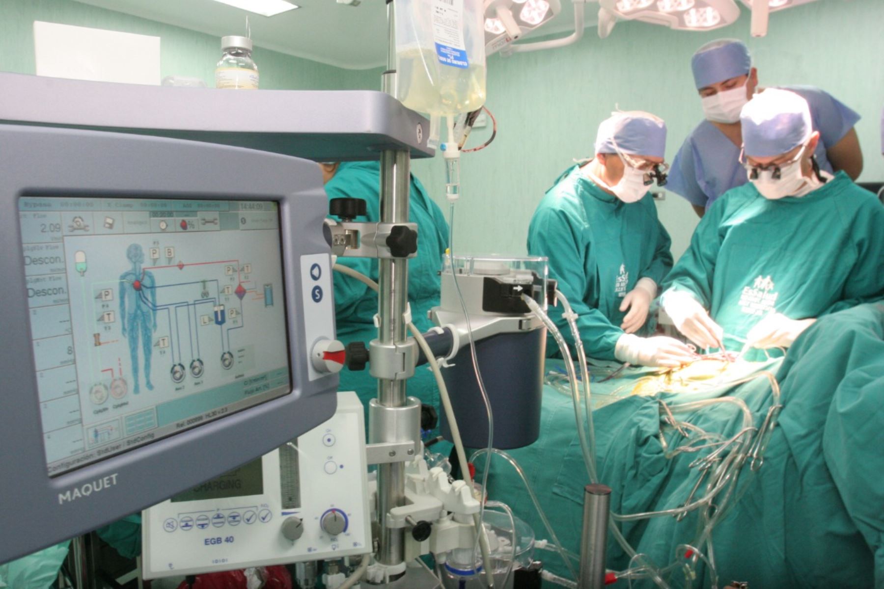 Proeza médica en Áncash: médicos de EsSalud extirpan tumor de 7 kilos a madre de 51 años