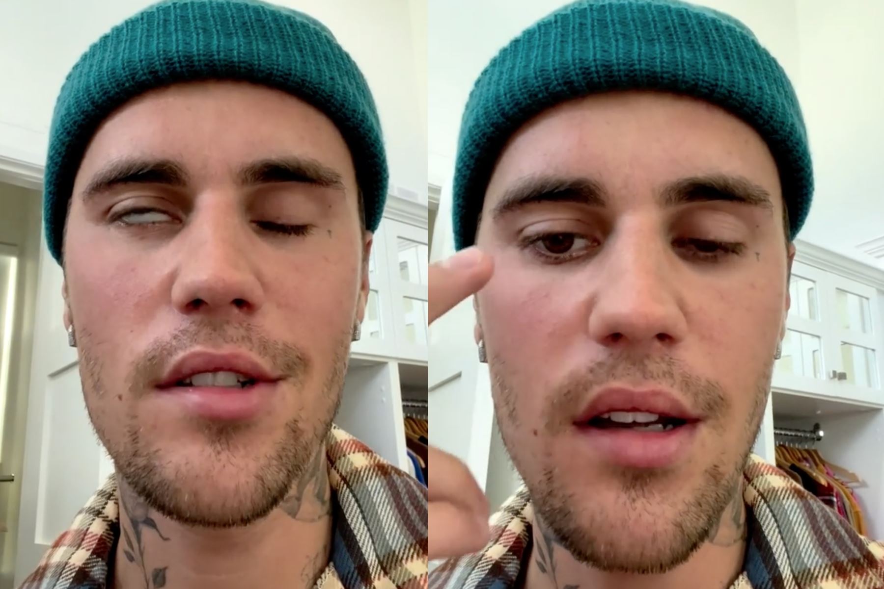 "Como pueden ver, este ojo no está pestañeando, no puedo sonreír en este lado de mi cara y esta narina no se mueve", explicó Bieber en la grabación. Foto: Composición con fotos de Instagram