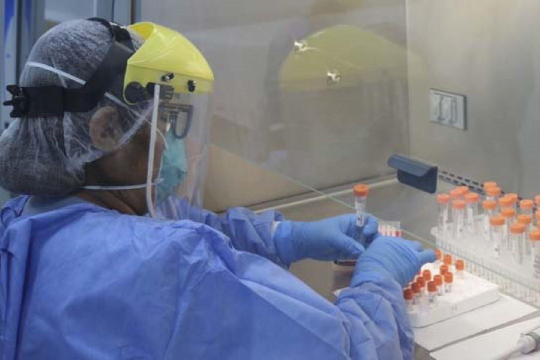 El Laboratorio de Referencia Nacional de Virus de Respiratorios e Inmunoprevenibles del INS, será el responsable del diagnóstico de las muestras de la viruela del mono. Foto: ANDINA/Difusión