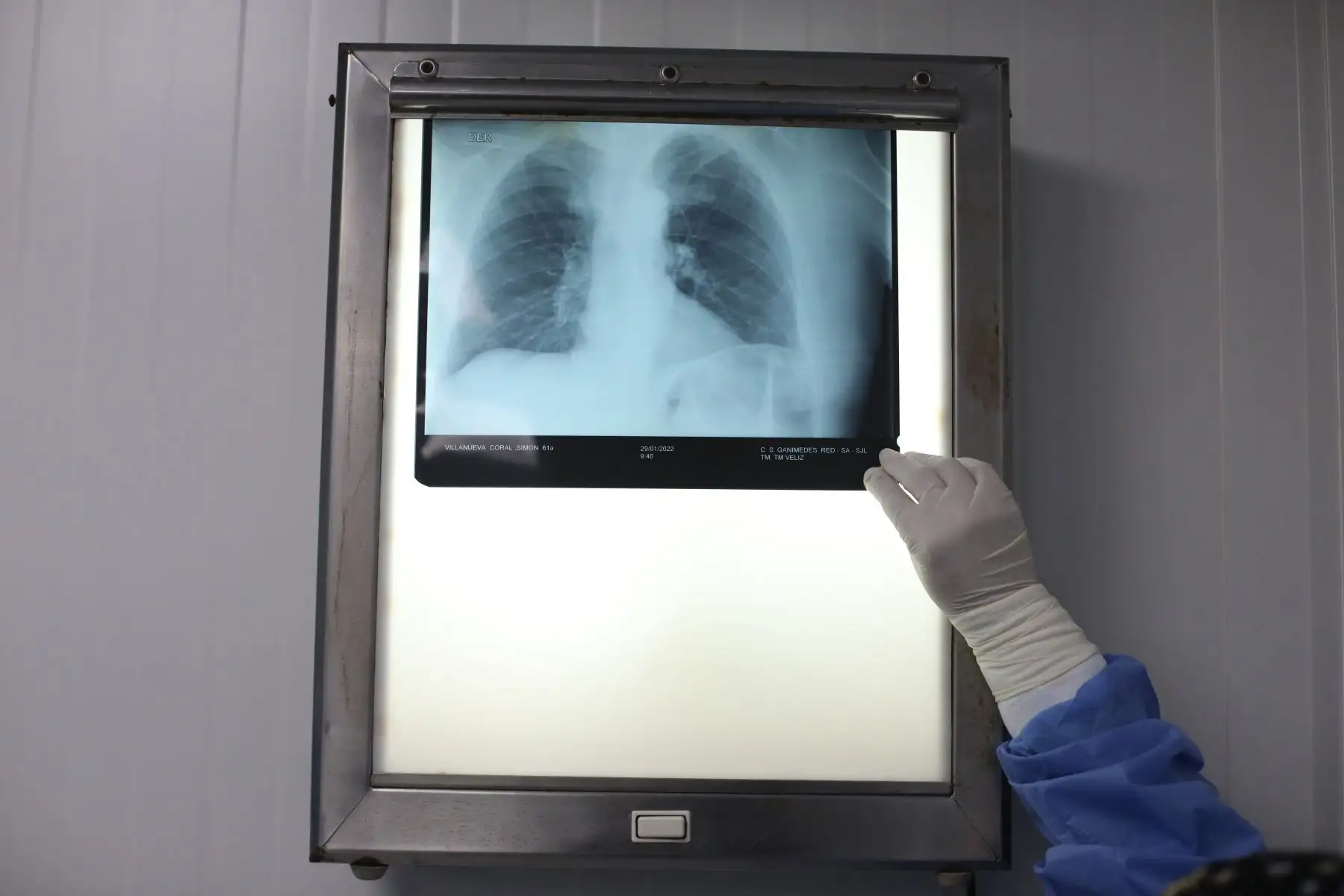 Especialistas de EsSalud enseñan a identificar los signos de alarma de estas afecciones respiratorias,  cómo usar adecuadamente los inhaladores para aquellas personas que sufren de asma o enfermedades obstructivas, además de precisar el tipo de vacunas que se deben aplicar en esta temporada de frío. Foto: ANDINA/ Carla Patiño