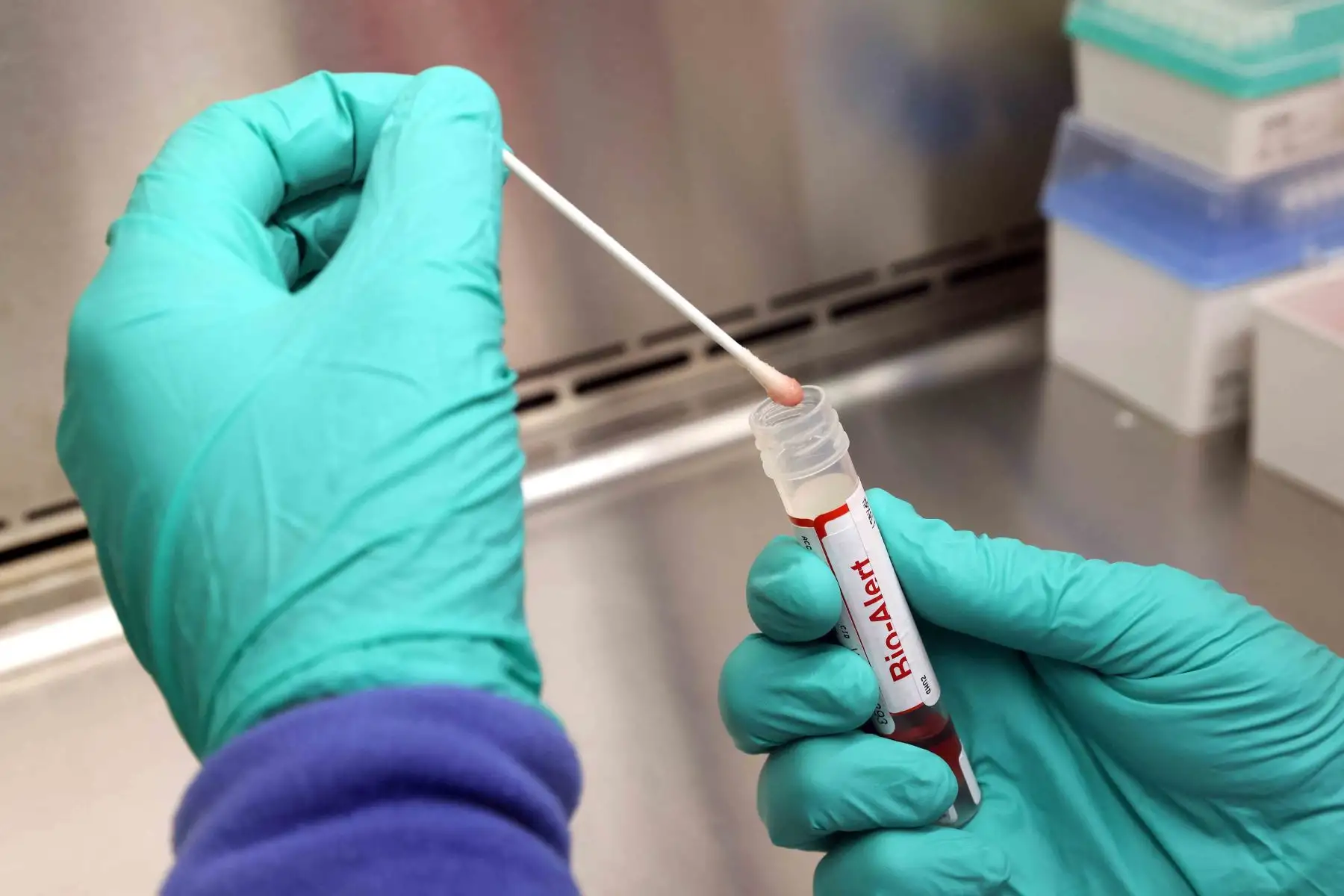 En un comunicado, los CDC indicaron que uno de los menores infectados es un residente en California de menos de dos años, mientras que el otro se encontraba en EE.UU., pero no reside habitualmente en el país. Foto: AFP