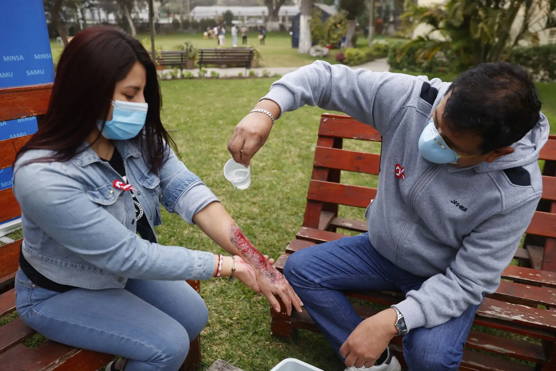 El primer paso para tratar las quemaduras es ponerlas en  agua a temperatura ambiente para que la herida no avance. Foto: ANDINA/Melina Mejía