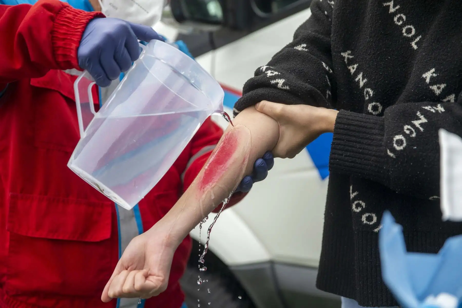 El Ministerio de Salud  a través del Sistema de Atención Móvil de Urgencia (SAMU), brinda recomendaciones  de primeros auxilios.
Se muestra como  debería reaccionar la ciudadanía en casos de caídas, fracturas, quemaduras o hemorragias y también dieron un ejemplo de reanimación cardiopulmonar (RCP).
Foto: ANDINA/Carla Patiño Ramírez