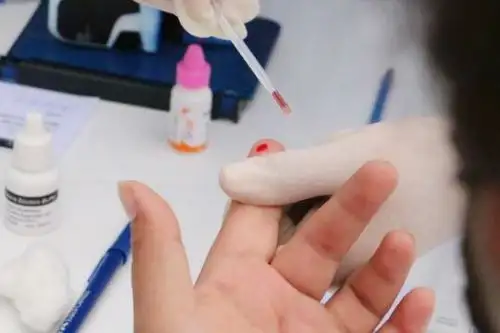 La muestra se envió al Instituto Nacional de Salud y se esperan los resultados en dos o tres días. Foto: ANDINA/Difusión