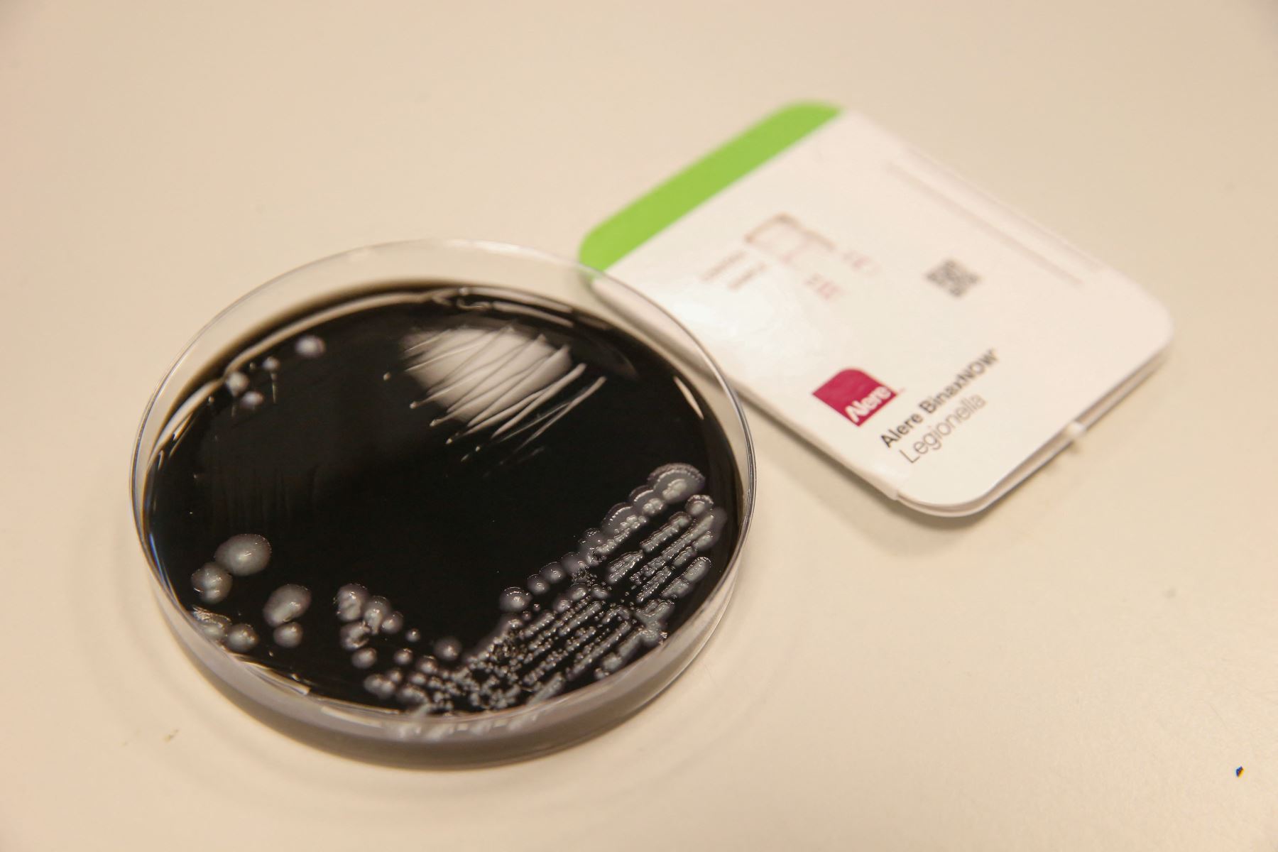 Una fotografía tomada el 17 de mayo de 2019 muestra un cultivo de la bacteria Legionella pneumophila en el hospital UZ Gent. Foto: AFP