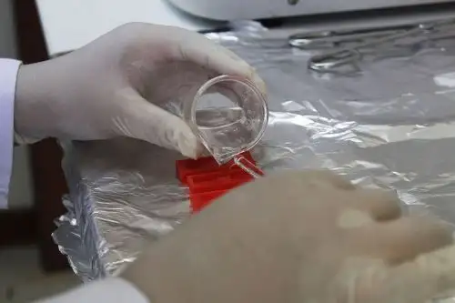 El objetivo es desarrollar módulos microfluídicos para aplicaciones lab-on-a-chip mediante modelado numérico, estudio de métodos de fabricación y caracterización de plataformas microfluídicas.