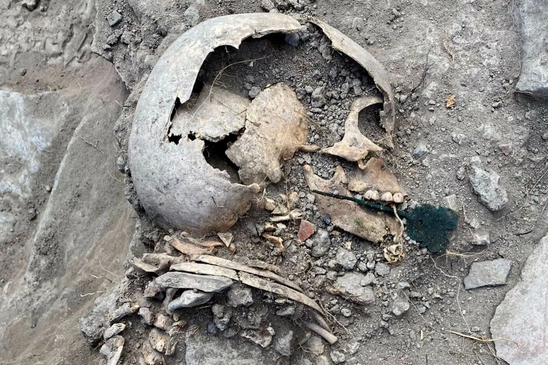 Un nuevo hallazgo arqueológico fue reportado en Cajamarca. En esta oportunidad el descubrimiento se efectuó en la colina Santa Apolonia, el emblemático atractivo de la capital, donde se encontraron restos óseos de la época prehispánica, pertenecientes a dos infantes, colocados posiblemente a modo de ofrenda, durante los eventos de clausura de recintos de piedra. Foto: Cortesía/ Proyecto de Investigación Arqueológica de la Colina Santa Apolonia
