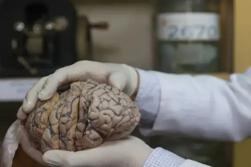 En el Día Mundial del Cebrero, el Ministerio de Salud recuerda la importancia de cuidar el cerebro, órgano que nos define como humanos. Foto: ANDINA/Andrés Valle