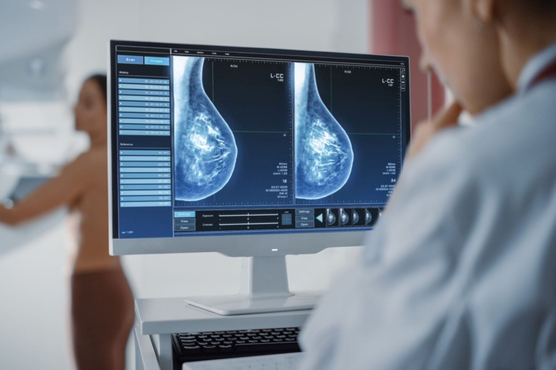 Especialistas recomiendan pruebas periódicas para la detección temprana del cáncer de mama. Foto: Cortesía Semáforo Oncológico/Difusión.