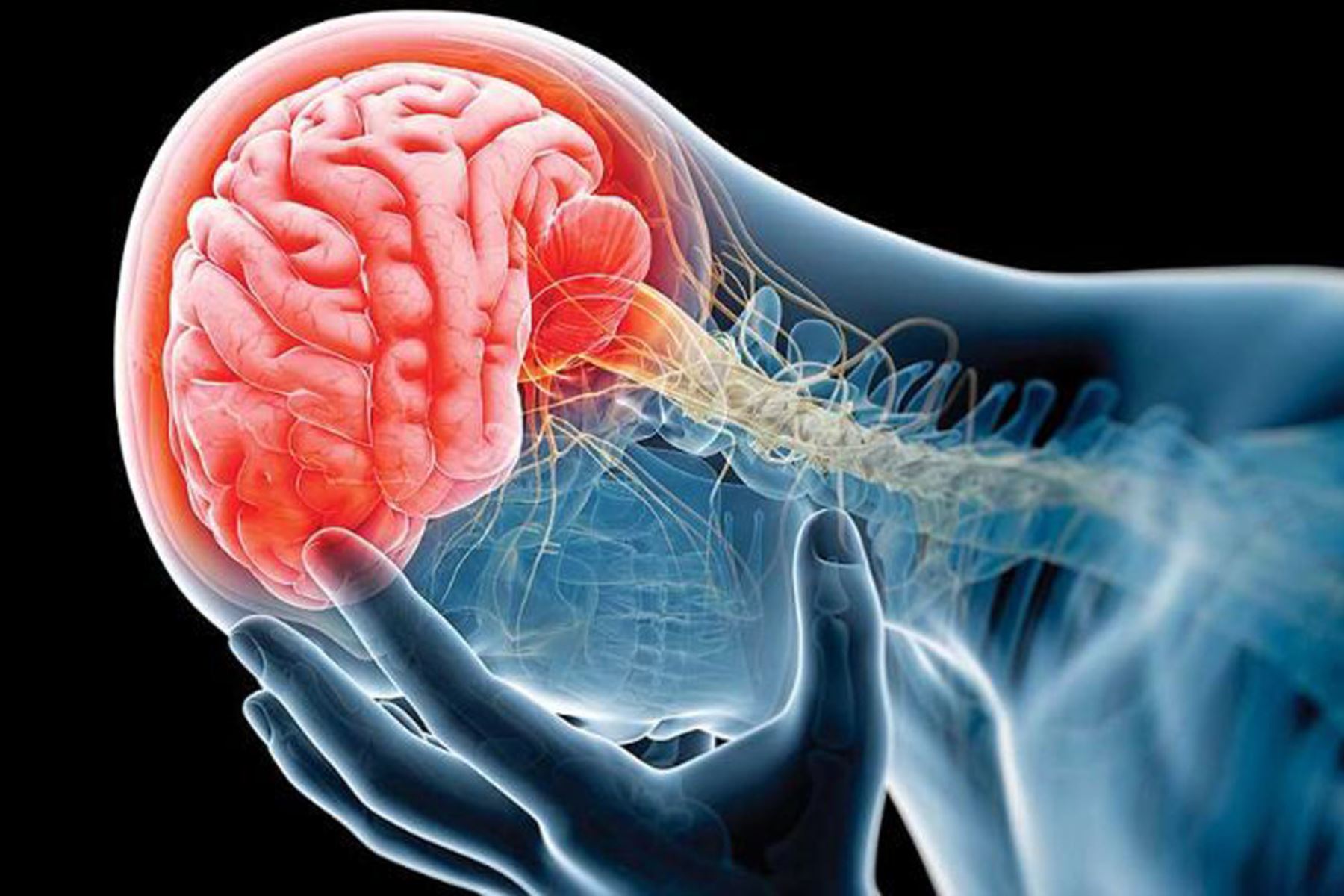 Acv O Derrame Cerebral A Mayor Demora En La Atención Médica Más Neuronas Perdidas Noticias 8355