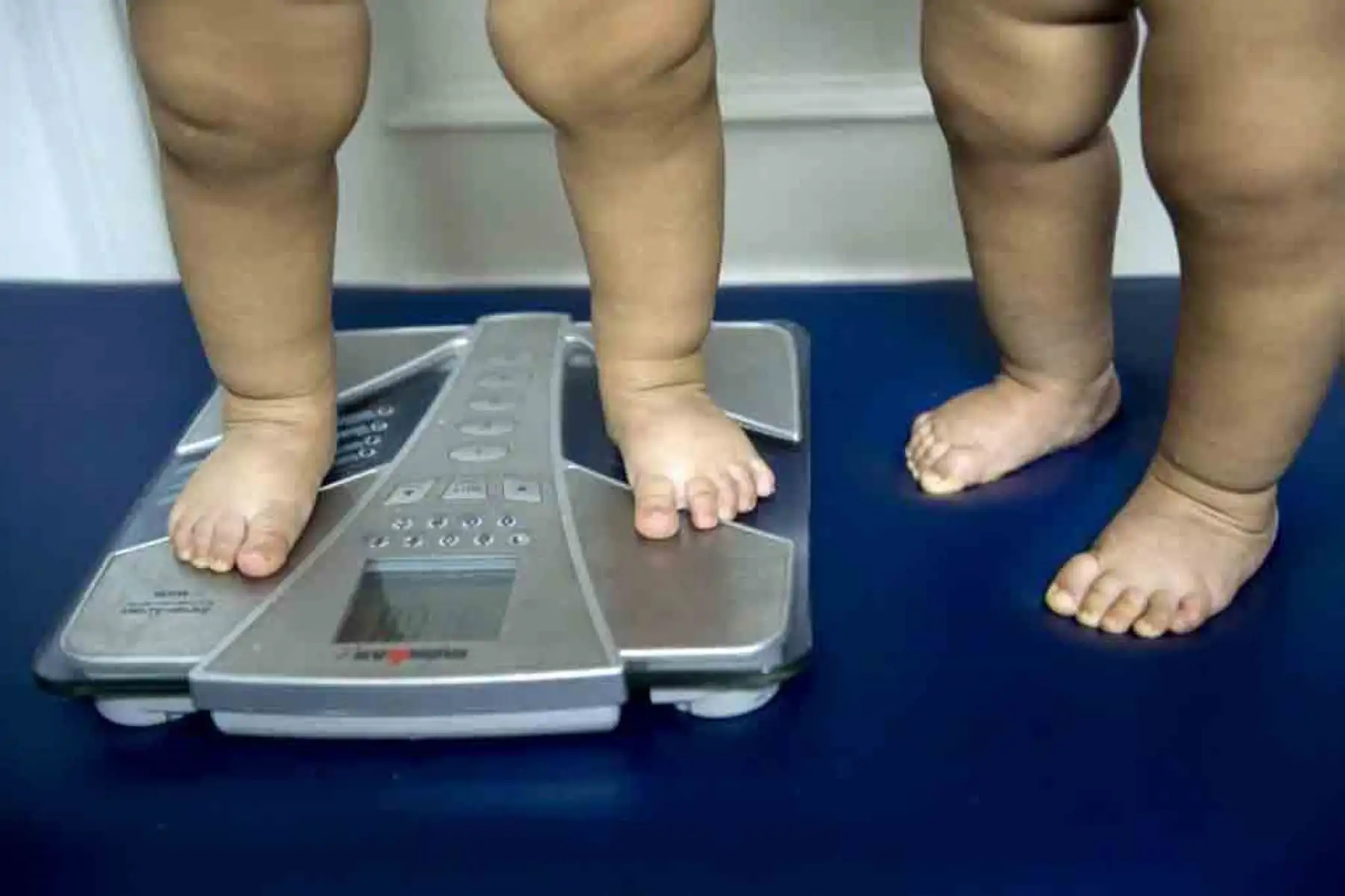 Se estima que en 2025, casi un tercio de la población será obesa, y más del 70 % tendrá sobrepeso. Expertos recomiendan fortalecer políticas públicas para combatir la mala alimentación y el sedentarismo. Foto: ANDINA/Archivo