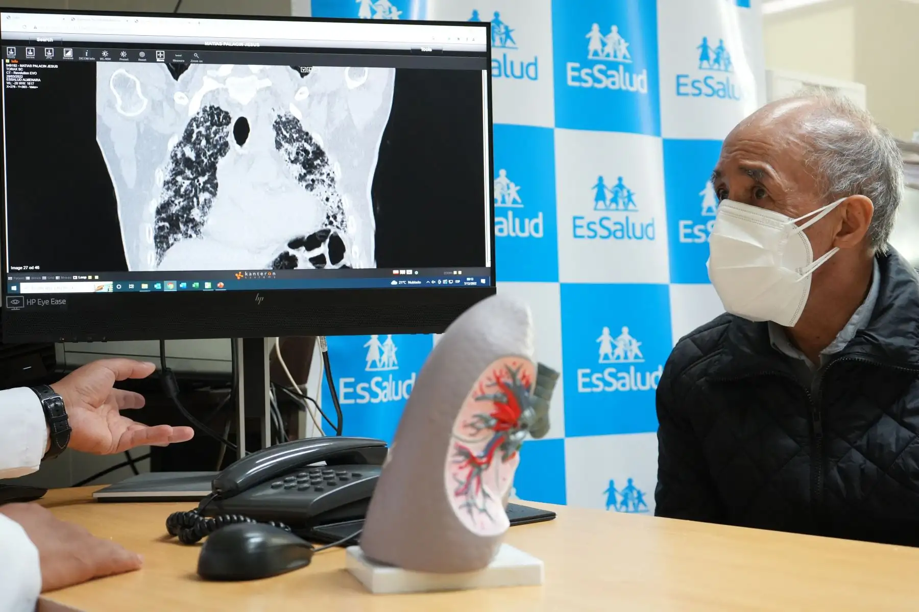 Jesús Melquiades Matías Palacín (65) , nos relata que desde hace 2 años dejó de trabajar porque pasó a ser dependiente de oxígeno. De acuerdo a la biopsia su enfermedad era hereditario autoinmune, por lo que se sentía deprimido. “Durante toda la pandemia tenía tos, sentía que se ahogaba y por la edad que tengo había perdido toda esperanza para un trasplante”. Foto: EsSalud