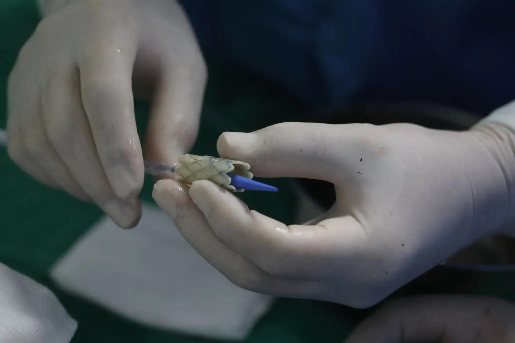 De enero a noviembre del 2022, el Instituto Nacional Cardiovascular (INCOR) del Seguro Social de Salud (EsSalud) operó a 892 pacientes cardíacos, 551 adultos y 341 pediátricos, sobre todo en cirugías mayores de alta complejidad. Foto: Difusión