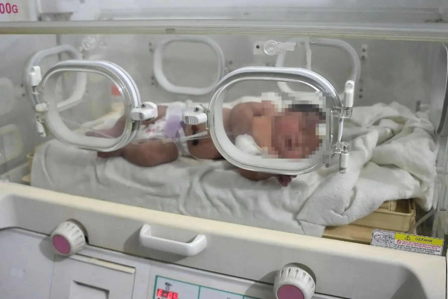 Un bebé recién nacido que fue encontrado todavía atado por su cordón umbilical a su madre y sacado con vida de los escombros de una casa en el norte de Siria luego de un terremoto mortal, recibe atención médica en una clínica en Afrin. Foto: AFP