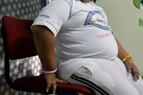 El exceso de grasa funciona como un aislante que reduce la capacidad del cuerpo para liberar calor, lo que incrementa la acumulación térmica y, con ello, el riesgo de deshidratación. Esta vulnerabilidad se acentúa si no se mantiene una adecuada hidratación durante los días de intenso calor. AFP