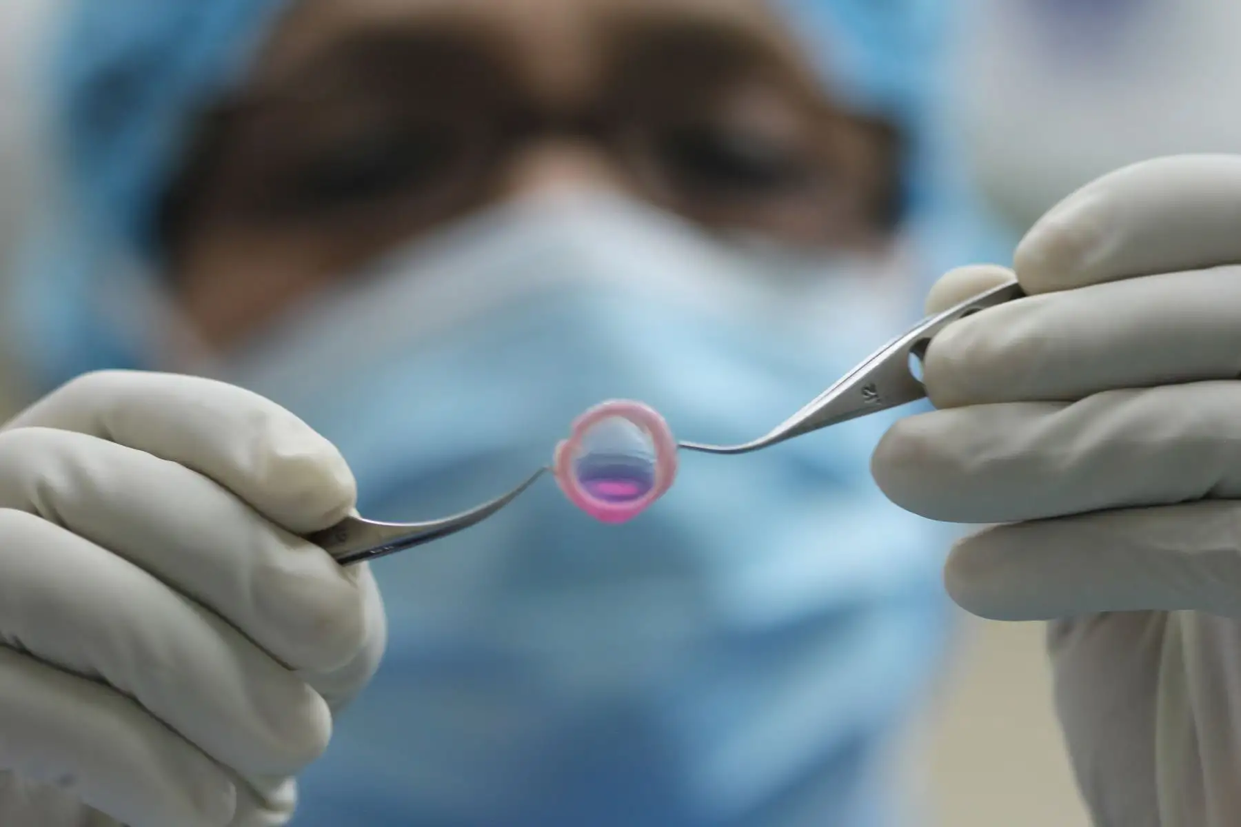 La reacción y el procedimiento de trasplante en el hospital Almenara demuestran, una vez más, la preparación del equipo de profesionales médicos y la capacidad operativa de EsSalud para atender este tipo de casos.
Foto: EsSalud