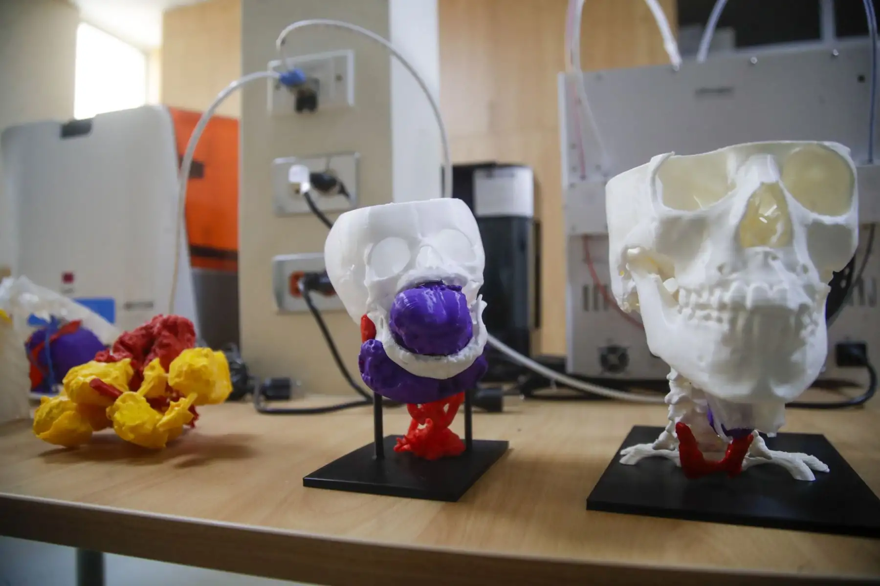El Instituto Nacional de Salud del Niño San Borja es el único centro hospitalario pediátrico en Perú que utiliza la innovadora técnica de impresión 3D en cirugía.