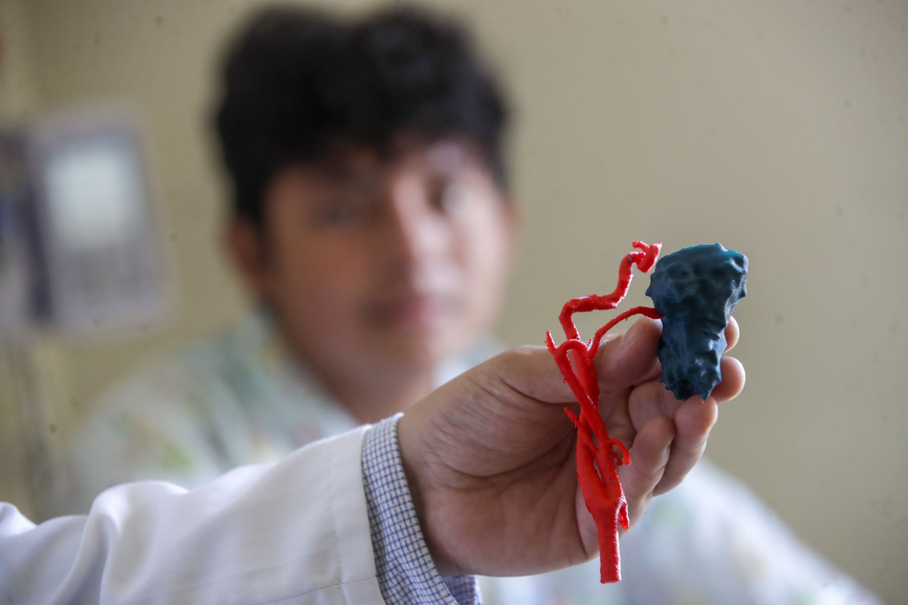 El Instituto Nacional de Salud del Niño San Borja es el único centro hospitalario pediátrico en Perú que utiliza la innovadora técnica de impresión 3D en cirugía.
