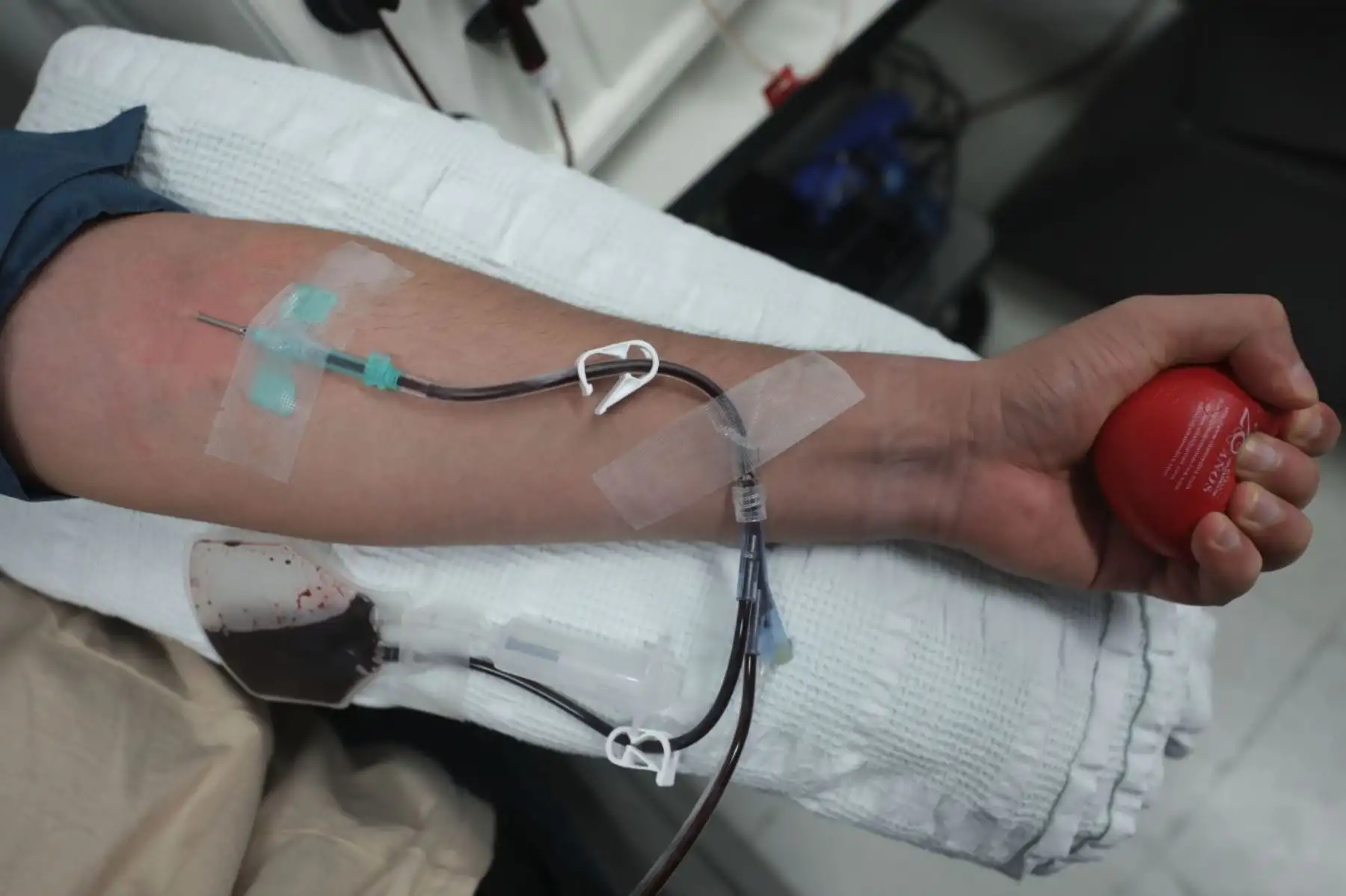 La importancia del Día Mundial de la Hemofilia no se limita a la sensibilización. Puede animar a los pacientes a consultar con un hematólogo lo antes posible, sobre todo teniendo en cuenta que un gran número de personas siguen sin ser diagnosticadas a pesar de los avances médicos. Este retraso suele provocar daños articulares evitables, episodios de sangrado recurrentes y una menor calidad de vida.ANDINA/Difusión