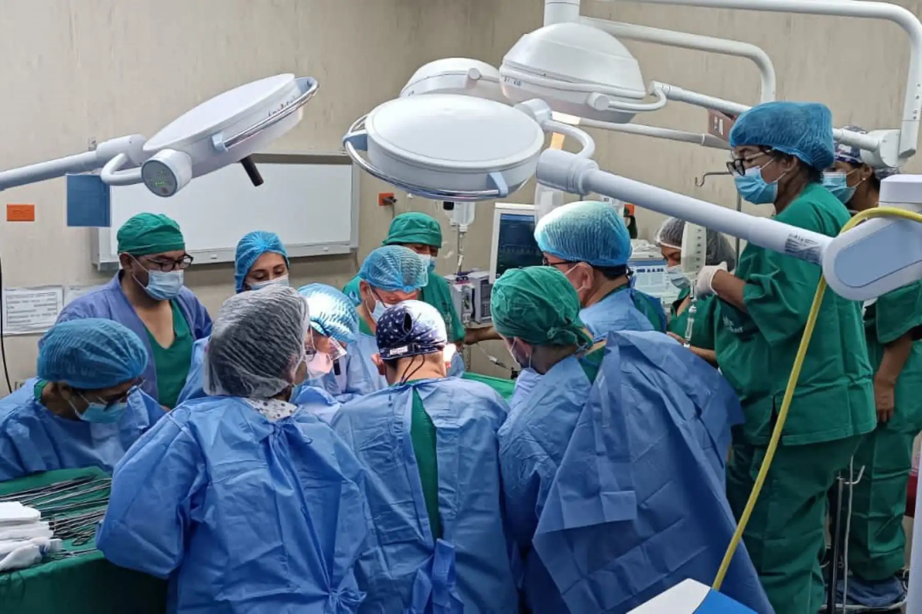 El corazón se destinará a un paciente en estado crítico de Incor, mientras que el hígado será divido en dos por medio de la técnica Split para beneficiar a un paciente adulto y otro pediátrico del hospital Almenara. Las córneas y los riñones serán derivados a otros hospitales de la capital.
Foto: ANDINA/EsSalud