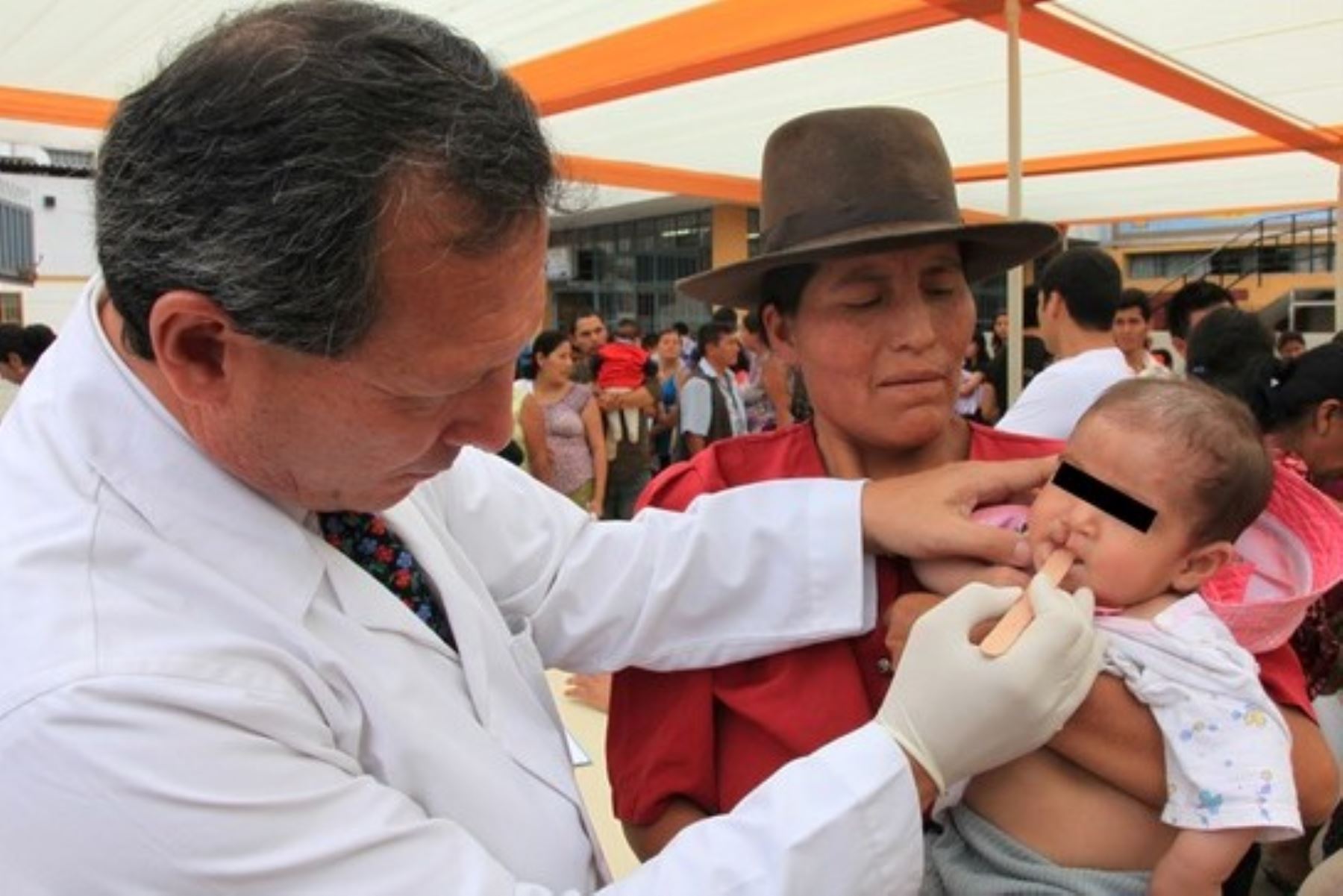 Ciento ochenta personas con fisura de labio palatina serán los primeros pacientes en ser operados durante el año 2023 en el Hospital Nacional Daniel Alcides Carrión del Callao. Foto:ANDINA/Difusión