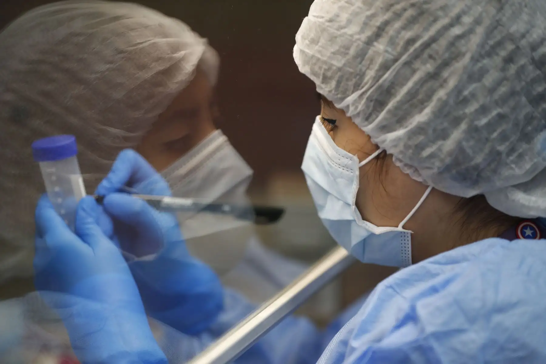 Según el Instituto Nacional de Salud, en el Perú existen actualmente 3 genotipos de dengue, de los cuales el de más prevalencia es el denominado "cosmopolitan". A nivel nacional, existen 49 laboratorios para el diagnóstico del dengue. Foto: ANDINA/Daniel Bracamonte