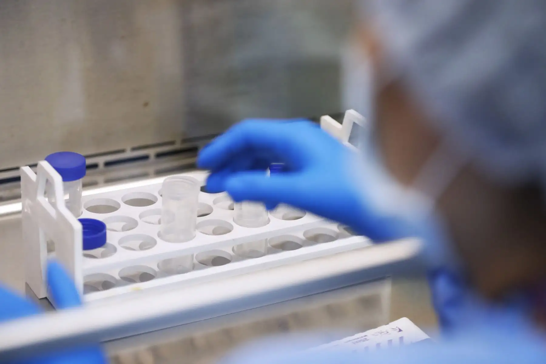 Según el Instituto Nacional de Salud, en el Perú existen actualmente 3 genotipos de dengue. A nivel nacional, existen 49 laboratorios para el diagnóstico del dengue. Foto: ANDINA/Daniel Bracamonte