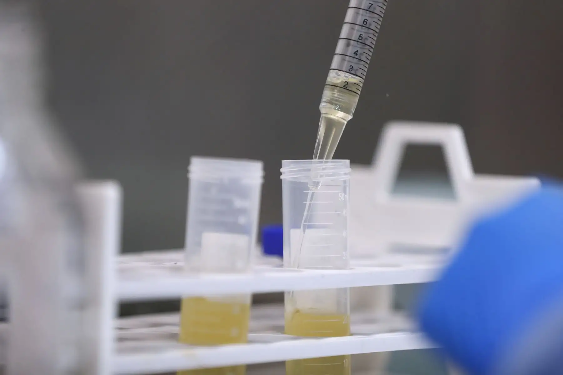 Según el Instituto Nacional de Salud, en el Perú existen actualmente 3 genotipos de dengue, de los cuales el de más prevalencia es el denominado "cosmopolitan". Para el descarte de esta enfermedad, se realizan pruebas serológicas y antígenas en los centros de salud a nivel nacional. Foto: ANDINA/Daniel Bracamonte