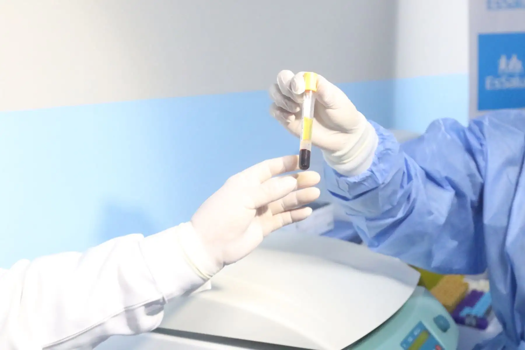 Essalud implementó pruebas moleculares que diagnostican dengue,zica y chikungunya en solo dos horas.FOTO:ANDINA/Hector Vinces.
