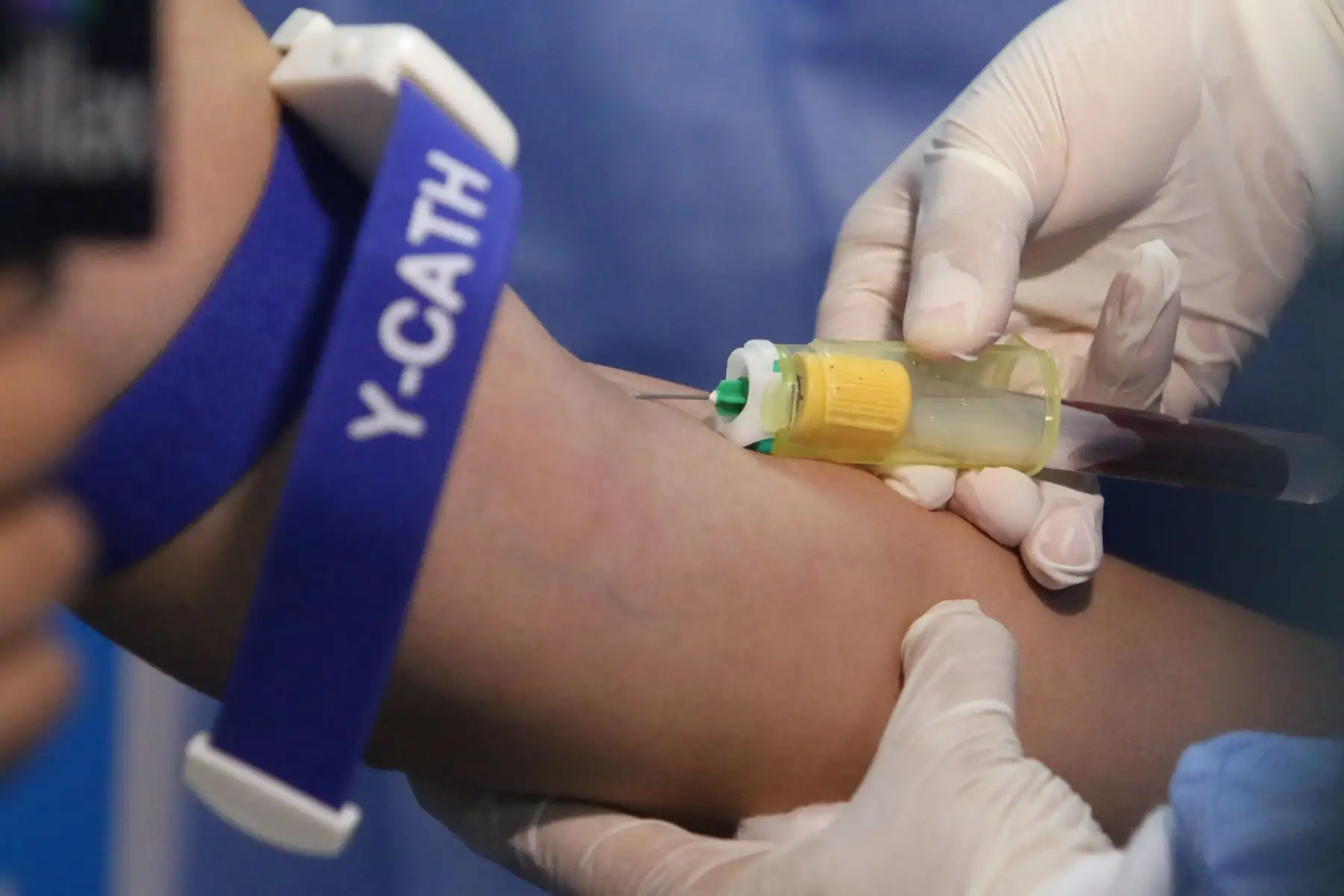 Essalud implementó pruebas moleculares que diagnostican dengue,zica y chikungunya en solo dos horas.FOTO:ANDINA/Hector Vinces.