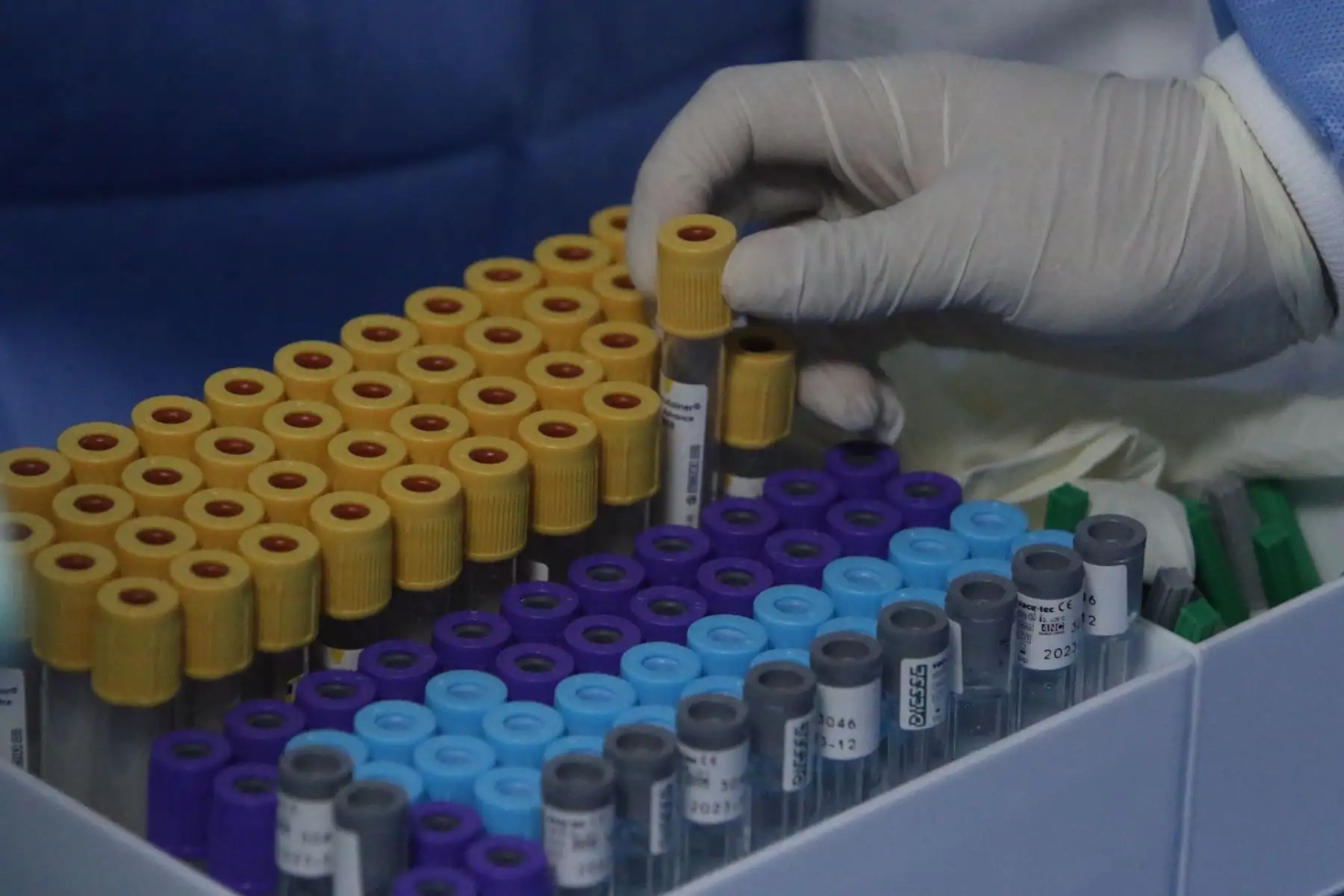Essalud implementó pruebas moleculares que diagnostican dengue,zica y chikungunya en solo dos horas.FOTO:ANDINA/Hector Vinces.