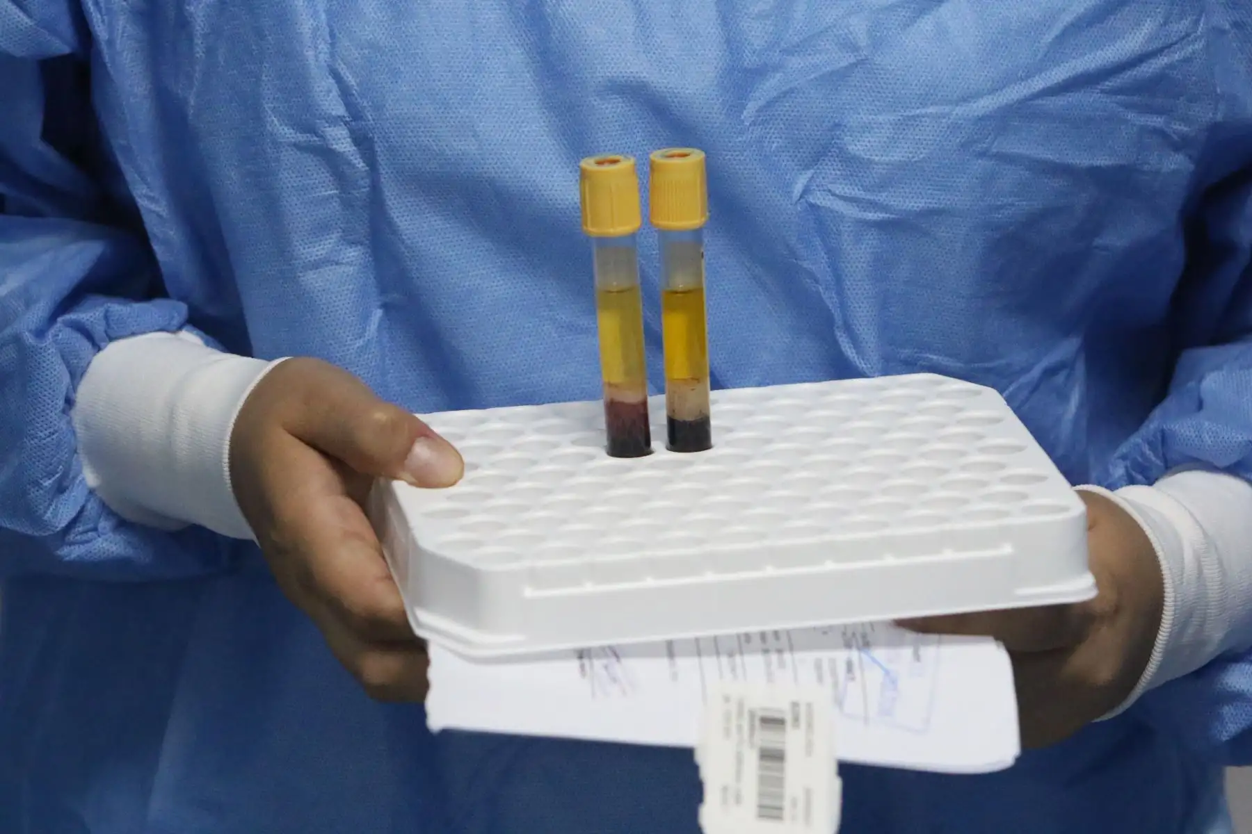 Essalud implementó pruebas moleculares que diagnostican dengue,zica y chikungunya en solo dos horas.FOTO:ANDINA/Hector Vinces.