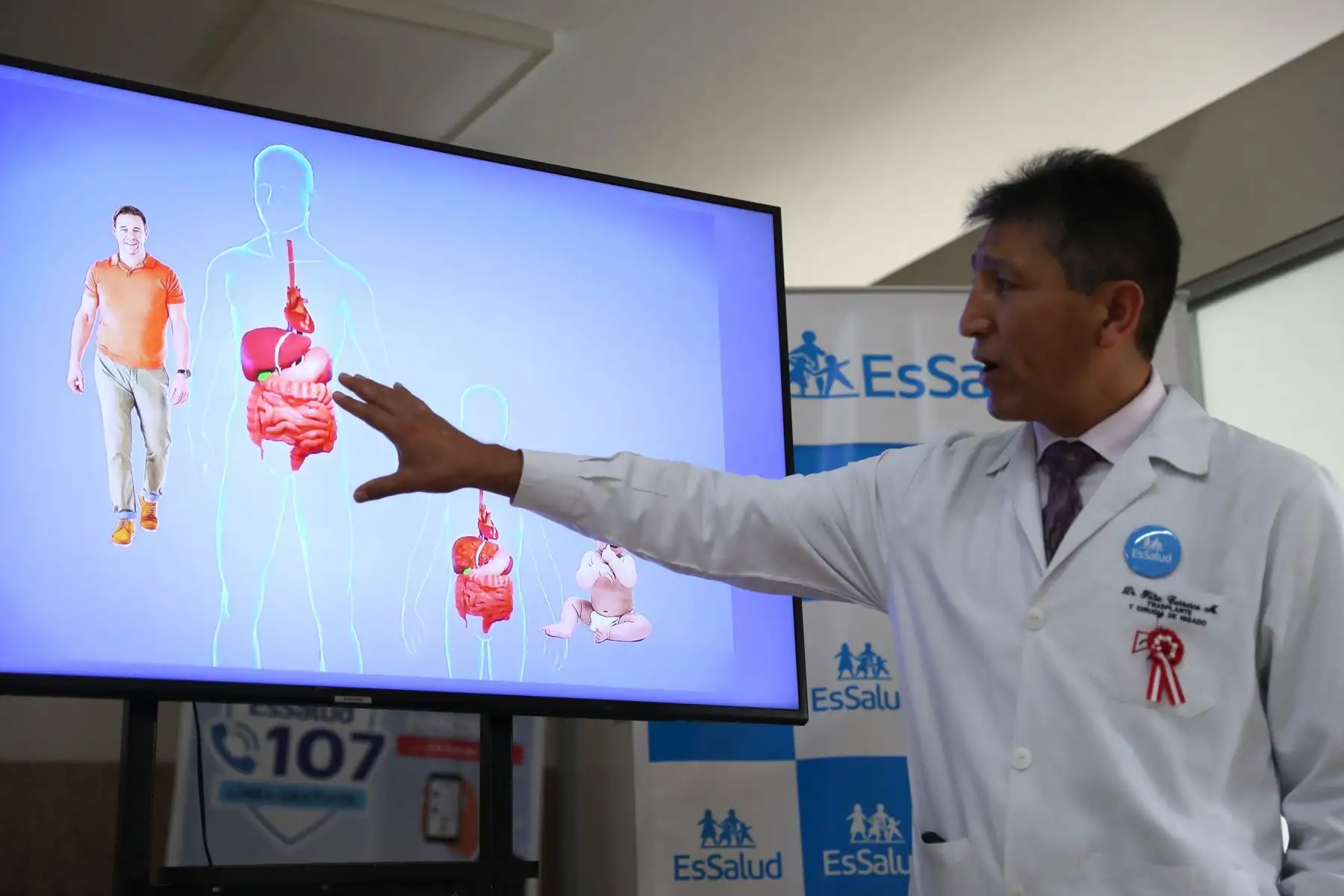 El Dr. Félix Carrasco, jefe de Trasplante de Hígado del Hospital Guillermo Almenara de EsSalud, explica cómo se realizó la operación de trasplante de hígado a través de la técnica split o de bipartición hepática, con la cual se salvó la vida de la joven Yuzen Deza Vilca y de la bebé Lauren Gálvez Guerrero. Foto: ANDINA/Daniel Bracamonte