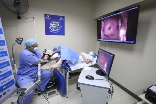 EsSalud realizó 297,926 pruebas de papanicolaou, un examen que sirve para prevenir y detectar el cáncer de cuello uterino. ANDINA/ EsSalud.