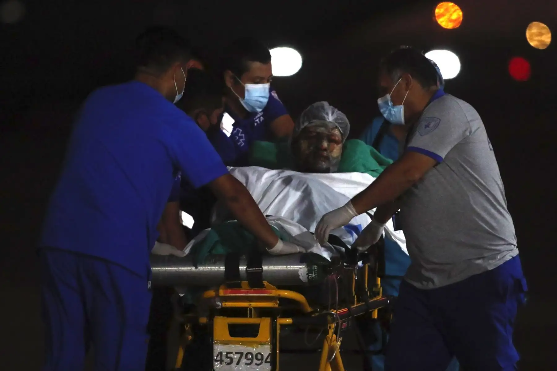 Tres inspectores de la Sutran heridos de gravedad, que fueron víctimas de un atentado en Apurímac por parte de desconocidos, llegaron a Lima para recibir atención médica. Foto: ANDINA/Daniel Bracamonte
