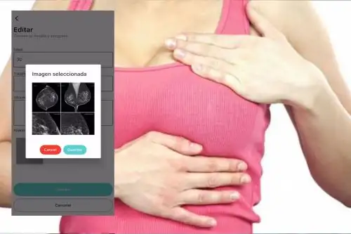La aplicación, denominada Oncoguard, podría cambiar la vida de millones de mujeres en el mundo.