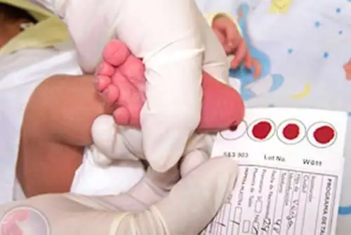 El Tamizaje Neonatal Universal, por lo menos de enfermedades metabólicas,asegura la detección temprana de siete enfermedades. ANDINA/ INPMN.